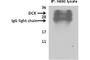 Deoxycytidine kinase(DCK) immunoprecipitated from H460cells with 7. (DCK anticorps  (C-Term))