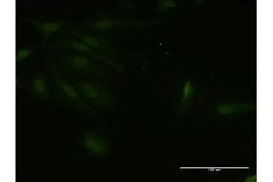 Immunofluorescence of monoclonal antibody to RNF125 on HeLa cell. (RNF125 anticorps  (AA 143-231))