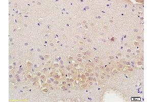 Formalin-fixed and paraffin embedded mouse kidney labeled with Anti RASSF3 Polyclonal Antibody, Unconjugated (ABIN762101) at 1:200 followed by conjugation to the secondary antibody and DAB staining