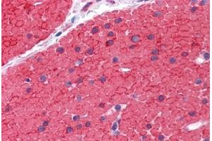 Human Small Intestine, muscularis propria: Formalin-Fixed, Paraffin-Embedded (FFPE)