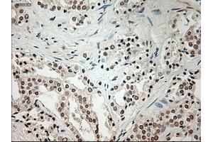 Immunohistochemical staining of paraffin-embedded Ovary tissue using anti-L1CAMmouse monoclonal antibody. (L1CAM anticorps)