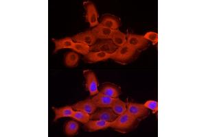 Immunofluorescence analysis of A-431 using Cortactin antibody (ABIN6127722, ABIN6139243, ABIN6139244 and ABIN6221478) at dilution of 1:25 (40x lens).