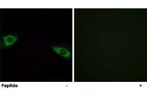 Immunofluorescence analysis of HUVEC cells, using RPS4Y1 polyclonal antibody . (RPS4Y1 anticorps  (C-Term))