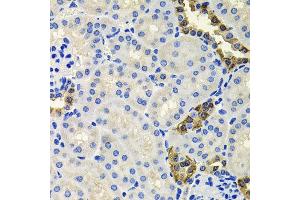 Immunohistochemistry of paraffin-embedded mouse kidney using CALB2 antibody at dilution of 1:100 (x40 lens). (Calretinin anticorps)