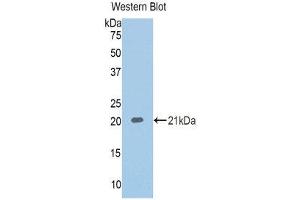Western Blotting (WB) image for anti-serpin Peptidase Inhibitor, Clade A (Alpha-1 Antiproteinase, Antitrypsin), Member 6 (SERPINA6) (AA 218-378) antibody (ABIN1859233)