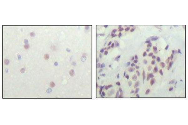 NCOR1 anticorps  (AA 1-192)