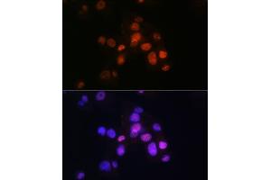 Immunofluorescence analysis of Hep G2 cells using HNF3β/HNF3β/FOX Rabbit mAb (ABIN7267232) at dilution of 1:100 (40x lens). (FOXA2 anticorps)