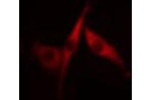 ABIN6266844 staining HeLa cells by IF/ICC.