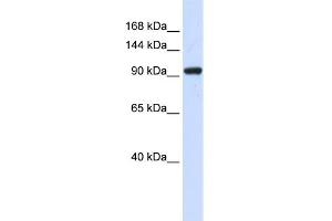WB Suggested Anti-ZNF452 Antibody Titration:  0. (SCAND3 anticorps  (N-Term))
