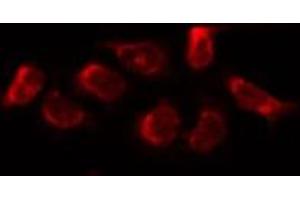 ABIN6269021 staining HUVEC by IF/ICC. (FSHR anticorps  (Internal Region))