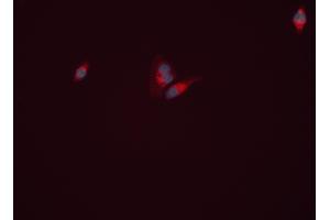 ABIN6261999 and ABIN6277813 staining HEPG2 cells by ICC/IF. (GLN1 anticorps  (C-Term))