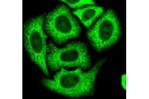 Immunofluorescence of HeLa cell line with EPRS polyclonal antibody . (EPRS anticorps)