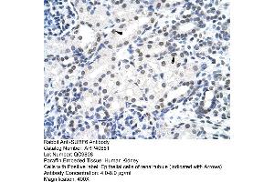 Rabbit Anti-SURF6 Antibody  Paraffin Embedded Tissue: Human Kidney Cellular Data: Epithelial cells of renal tubule Antibody Concentration: 4. (SURF6 anticorps  (Middle Region))
