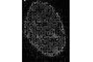 Immunofluorescence (IF) image for anti-Chromobox Homolog 3 (CBX3) (C-Term) antibody (ABIN2452035)