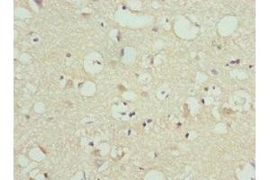 Immunohistochemistry of paraffin-embedded human brain tissue using ABIN7165737 at dilution of 1:100