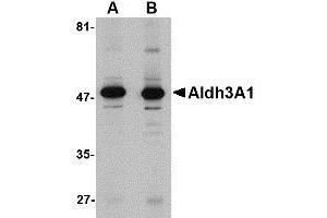 Western blot analysis of Aldh3A1 in human stomach lysate with AP30043PU-N Aldh3A1 antibody at (A) 1 and (B) 2 μg/ml. (ALDH3A1 anticorps  (C-Term))