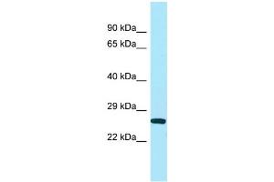 WB Suggested Anti-UQCC Antibody Titration: 1. (Ubiquinol-Cytochrome C Reductase Complex Chaperone (UQCC) (N-Term) anticorps)