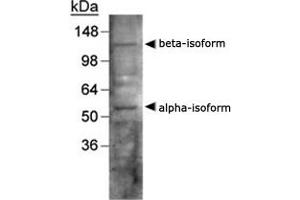 Western blot analysis of LXR in human liver using NR1H3/NR1H2 polyclonal antibody . (NR1H3 anticorps  (AA 50-150))