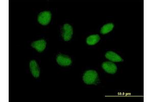 Immunofluorescence of purified MaxPab antibody to CGI-09 on HeLa cell. (TRMT6 anticorps  (AA 1-497))