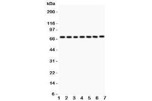 Western blot testing of FOXO3A antibody and Lane 1:  rat thymus (FOXO3 anticorps  (AA 471-673))