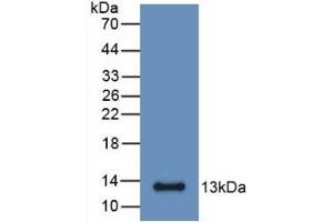 Detection of Recombinant S100A6, Mouse using Monoclonal Antibody to S100 Calcium Binding Protein A6 (S100A6) (S100A6 anticorps  (AA 1-89))