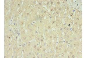 Immunohistochemistry of paraffin-embedded human liver tissue using ABIN7168454 at dilution of 1:100 (RNMTL1 anticorps  (AA 41-205))