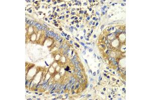 Immunohistochemistry of paraffin-embedded human colon using PICK1 antibody at dilution of 1:100 (x40 lens). (PICK1 anticorps)