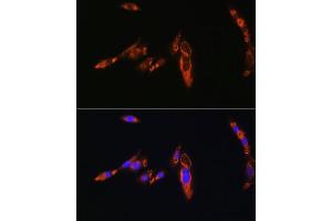 Immunofluorescence analysis of NIH/3T3 cells using A Rabbit pAb (ABIN6129944, ABIN6137377, ABIN6137378 and ABIN6224448) at dilution of 1:100. (AVPR1A anticorps  (AA 349-418))