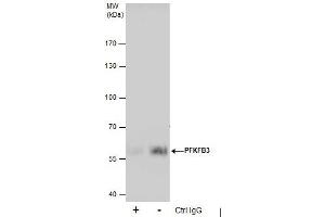 IP Image Immunoprecipitation of PFKFB3 protein from A431 whole cell extracts using 5 μg of PFKFB3 antibody [C3], C-term, Western blot analysis was performed using PFKFB3 antibody [C3], C-term, EasyBlot anti-Rabbit IgG  was used as a secondary reagent.