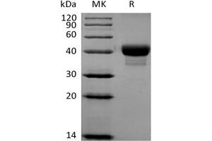 Western Blotting (WB) image for CD52 (CD52) protein (Biotin) (ABIN7319777) (CD52 Protein (CD52) (Biotin))