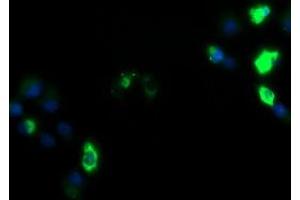 Image no. 3 for anti-Zinc Finger and SCAN Domain Containing 18 (ZSCAN18) antibody (ABIN1501858) (ZSCAN18 anticorps)