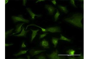 Immunofluorescence of monoclonal antibody to KLK2 on HeLa cell.