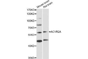 Western blot analysis of extracts of various cell lines, using ACVR2A antibody (ABIN5971030) at 1/1000 dilution. (ACVR2A anticorps)