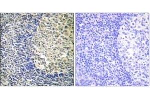 Immunohistochemistry analysis of paraffin-embedded human tonsil, using p47 phox (Phospho-Ser370) Antibody.