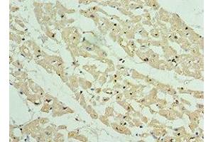 Immunohistochemistry of paraffin-embedded human heart tissue using ABIN7144071 at dilution of 1:100