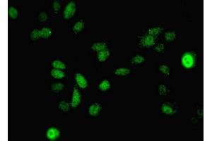 Immunofluorescent analysis of A549 cells using ABIN7150707 at dilution of 1:100 and Alexa Fluor 488-congugated AffiniPure Goat Anti-Rabbit IgG(H+L)