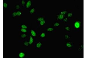 Immunofluorescent analysis of A549 cells using ABIN7150707 at dilution of 1:100 and Alexa Fluor 488-congugated AffiniPure Goat Anti-Rabbit IgG(H+L) (MAP2K3 anticorps  (AA 1-347))