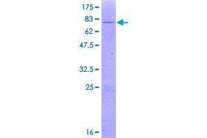 Image no. 1 for UDP-Glucuronate Decarboxylase 1 (UXS1) (AA 1-420) protein (GST tag) (ABIN7607770)
