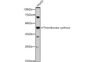 Western blot analysis of extracts of HepG2 cells, using Thromboxane synthase antibody (ABIN6132172, ABIN6148915, ABIN6148917 and ABIN6219149) at 1:500 dilution.