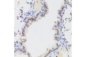 Immunohistochemistry of paraffin-embedded mouse lung using NASP Antibody. (NASP anticorps  (AA 180-449))