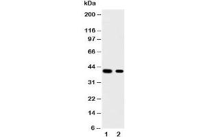 Western blot testing of KLF5 antibody and Lane 1:  HeLa;  2: MCF-7 cell lysate.