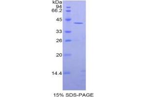 SDS-PAGE analysis of Rat CKM Protein. (CKM Protéine)