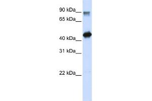 WB Suggested Anti-HMG20A Antibody Titration:  0. (HMG20A anticorps  (N-Term))