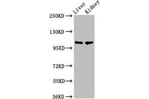 Western Blot Positive WB detected in: Rat liver tissue, Mouse kidney tissue All lanes: PEAR1 antibody at 5. (PEAR1 anticorps  (AA 932-1037))