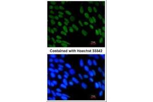 ICC/IF Image Immunofluorescence analysis of paraformaldehyde-fixed Human ESC, using ZNF198, antibody at 1:1000 dilution.