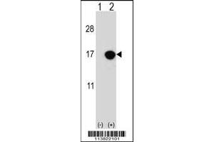 Western blot analysis of CDKN2B using rabbit polyclonal CDKN2B Antibody using 293 cell lysates (2 ug/lane) either nontransfected (Lane 1) or transiently transfected (Lane 2) with the CDKN2B gene.