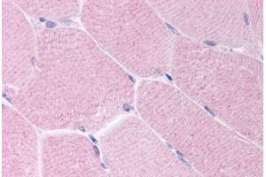 Human Skeletal Muscle (formalin-fixed, paraffin-embedded) stained with BARD1 antibody ABIN214634 at 10 ug/ml followed by biotinylated goat anti-rabbit IgG secondary antibody ABIN481713, alkaline phosphatase-streptavidin and chromogen. (BARD1 anticorps  (AA 108-124))