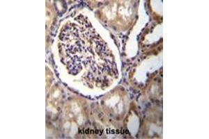 AKR1C3 Antibody (Center) immunohistochemistry analysis in formalin fixed and paraffin embedded human kidney tissue followed by peroxidase conjugation of the secondary antibody and DAB staining. (AKR1C3 anticorps  (Middle Region))