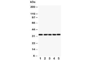 Western blot testing of E2F6 antibody and Lane 1:  HeLa (E2F6 anticorps  (Middle Region))