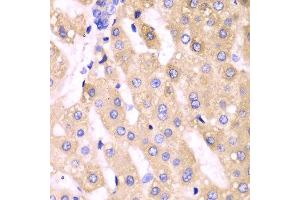 Immunohistochemistry (IHC) image for anti-Cytochrome P450, Family 3, Subfamily A, Polypeptide 4 (CYP3A4) (AA 244-503) antibody (ABIN3023346) (CYP3A4 anticorps  (AA 244-503))